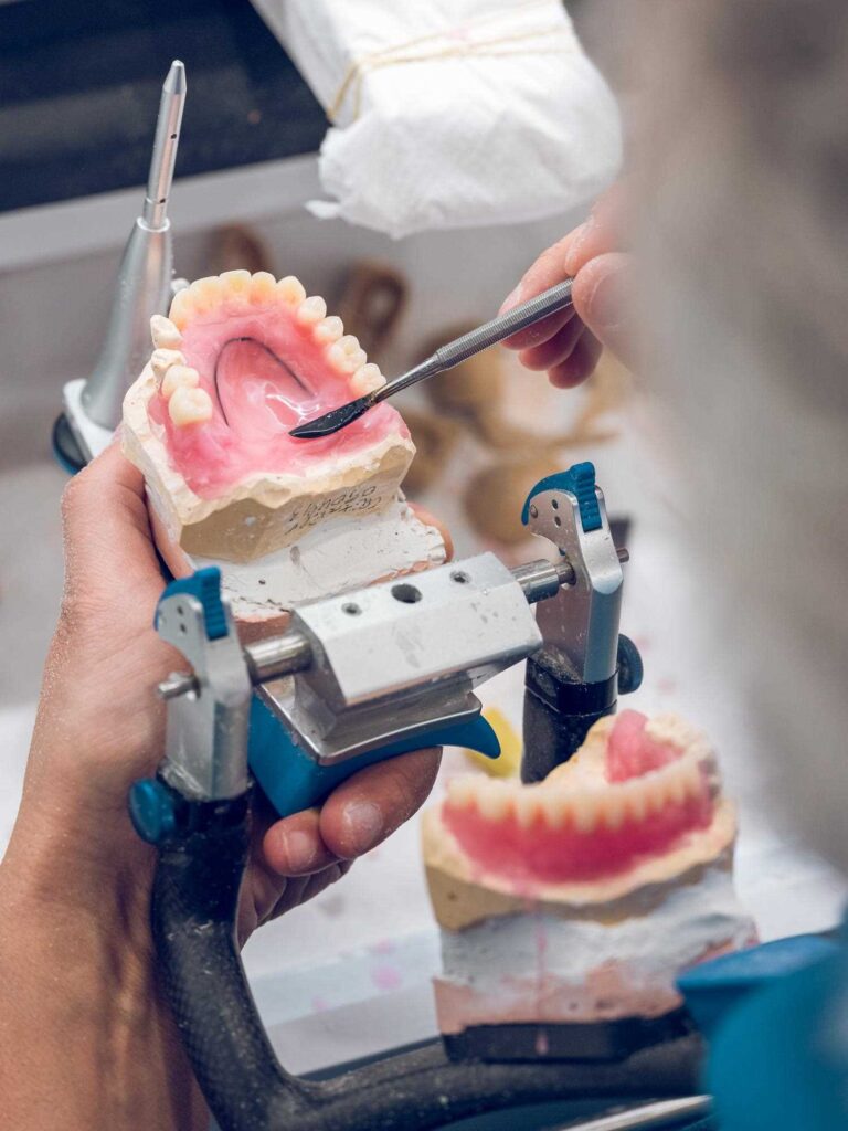 Doctor realizando una prótesis dental en equipo protésico