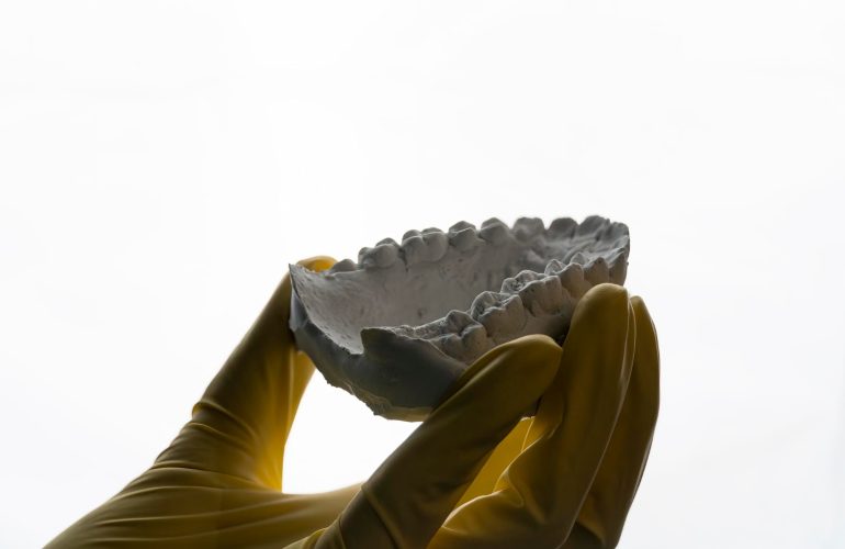 Mano de dentista mostrando un molde de prótesis dental. Trabajos con resina acrílica y circonio